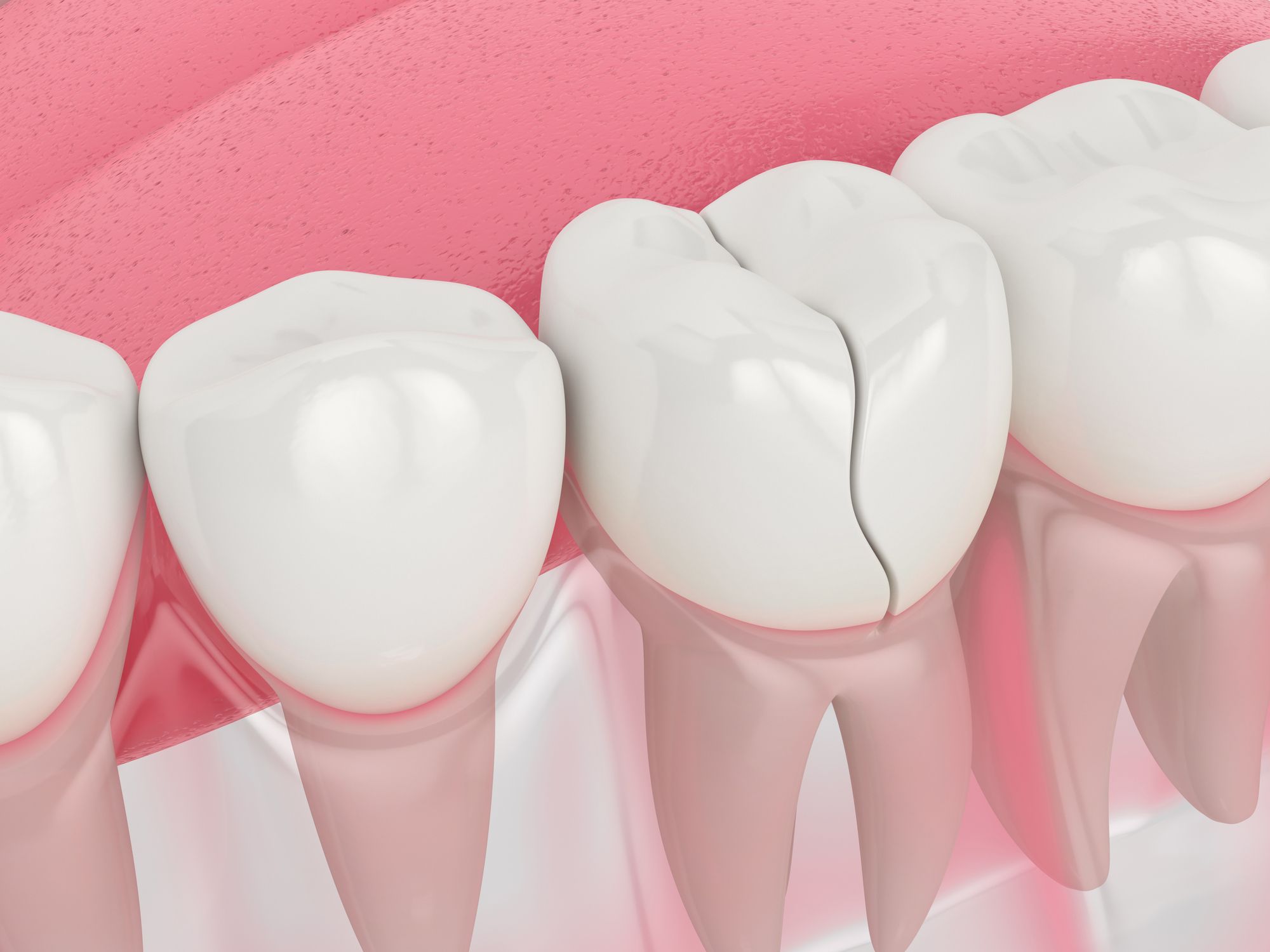 Odontología en Chiclana de la Frontera, tratamientos dentales en Chiclana de la Frontera.