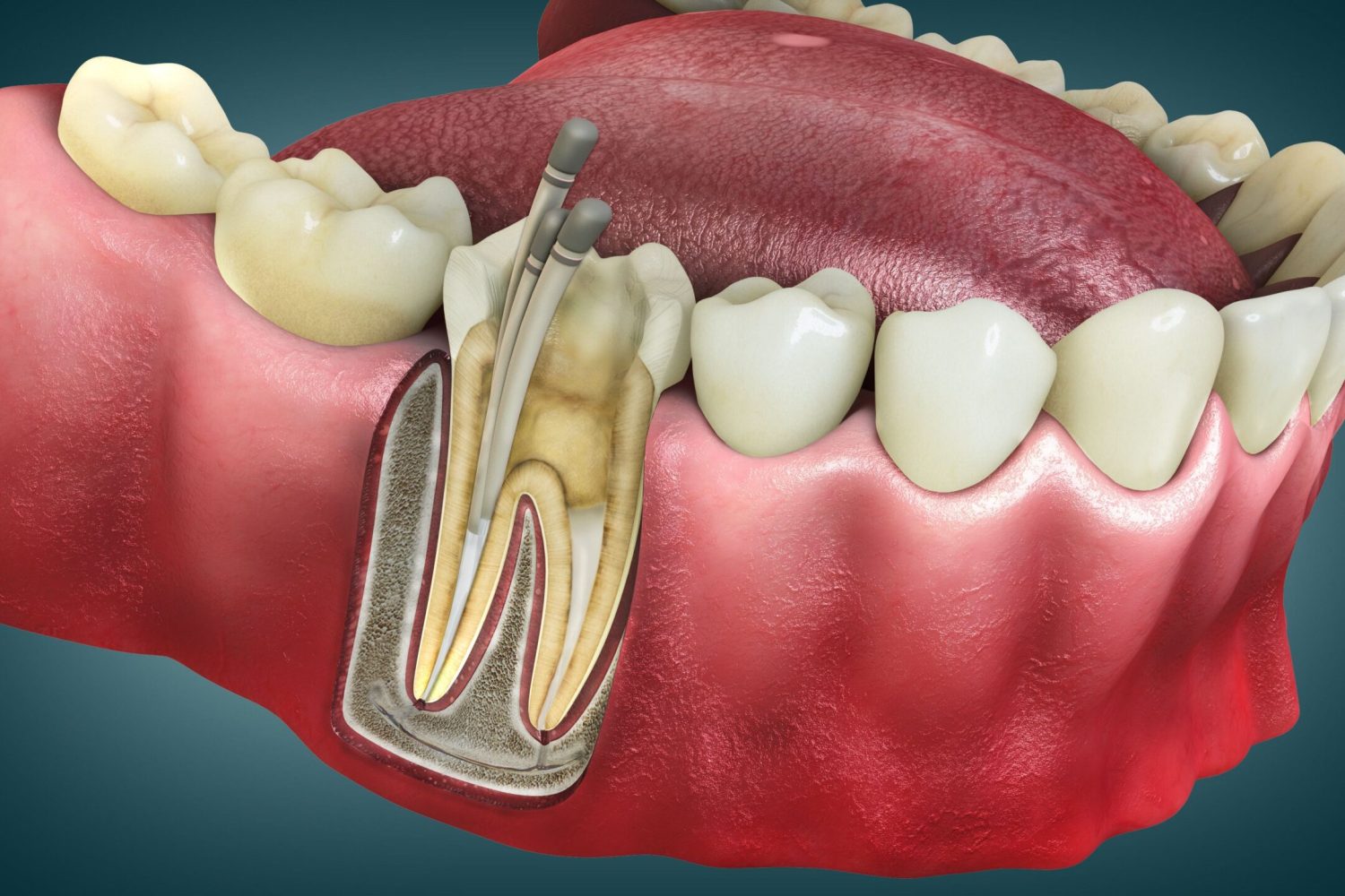 Cirugía oral en Chiclana de la Frontera. cirugía dental en Chiclana, cirugía bucodental en Chiclana.