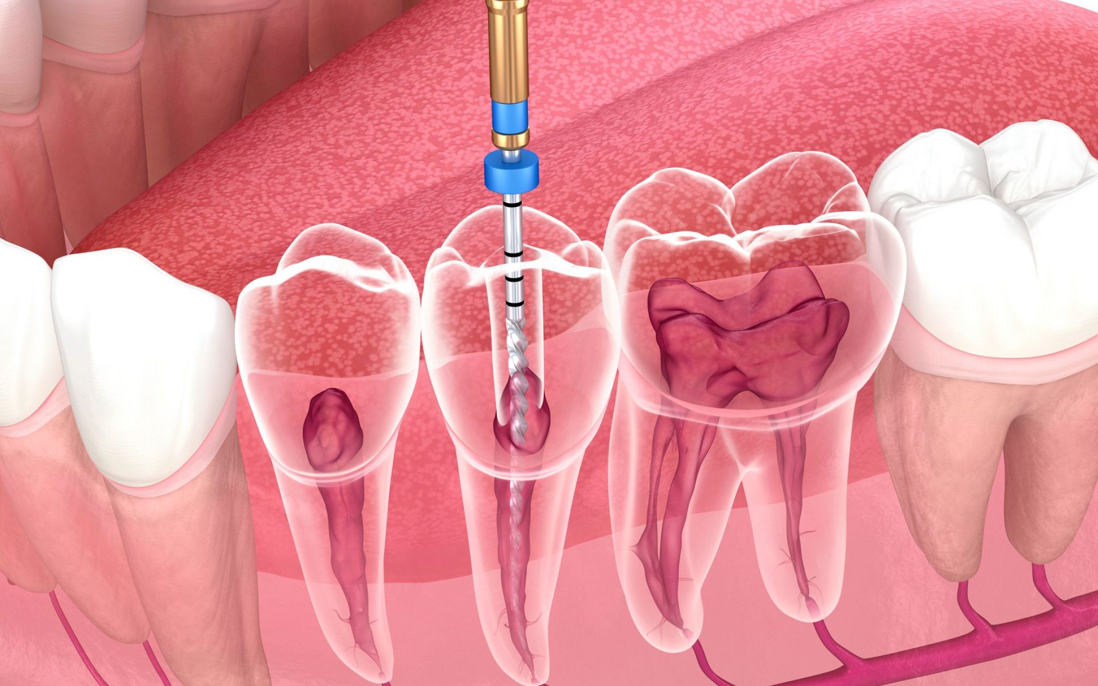 Odontología en Chiclana de la Frontera, tratamientos dentales en Chiclana de la Frontera.