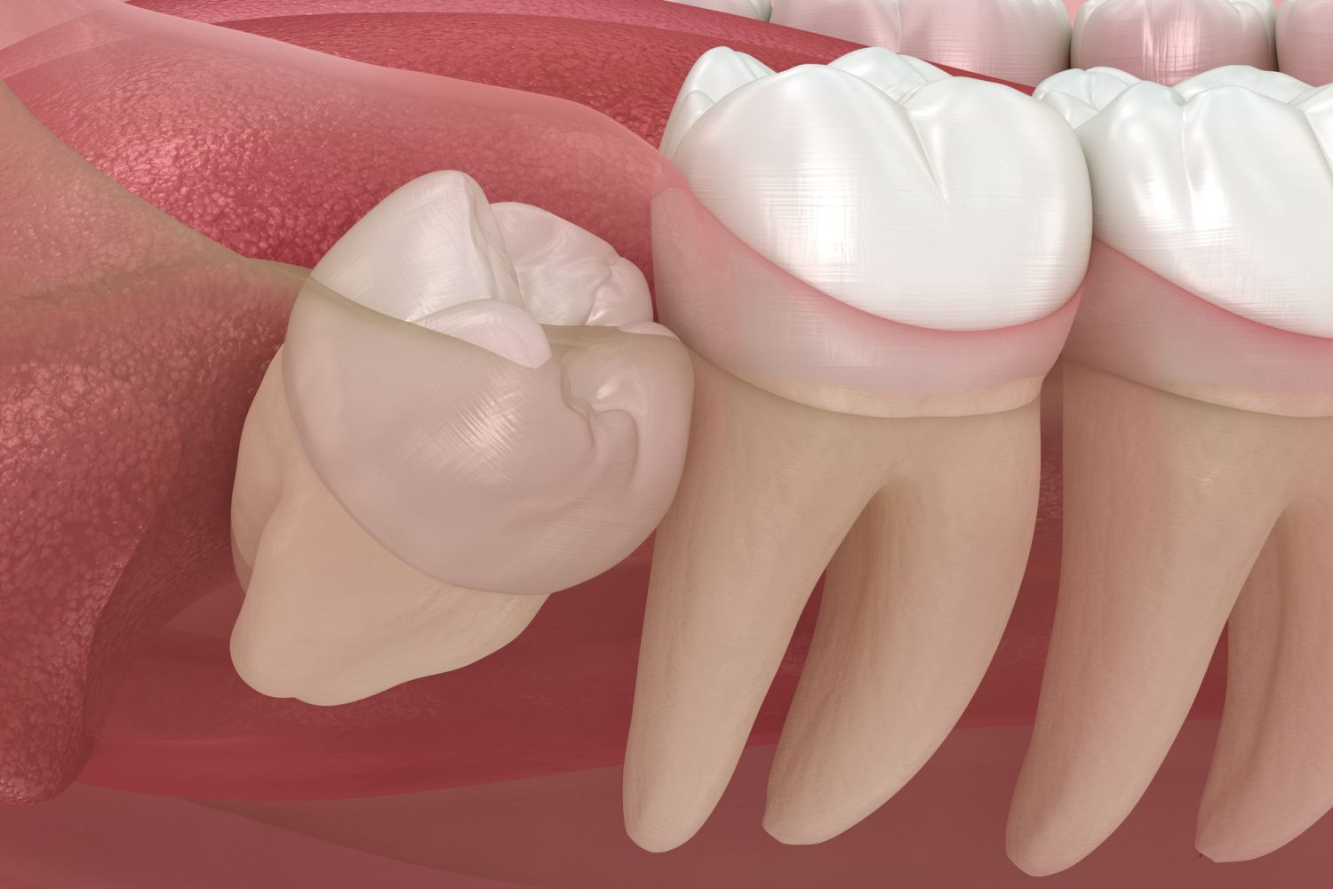 Odontopediatría en Chiclana de la Frontera, dentista para niños en Chiclana de la Frontera, odontología para niños en Chiclana, clínica dental para niños en Chiclana.