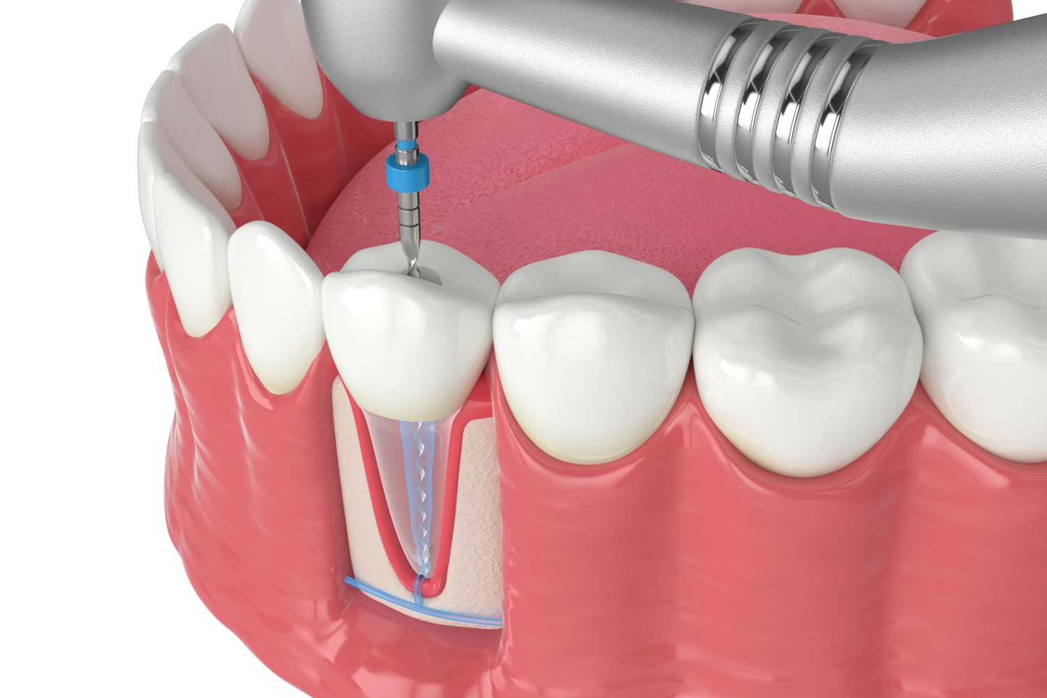 Odontopediatría en Chiclana de la Frontera, dentista para niños en Chiclana de la Frontera, odontología para niños en Chiclana, clínica dental para niños en Chiclana.