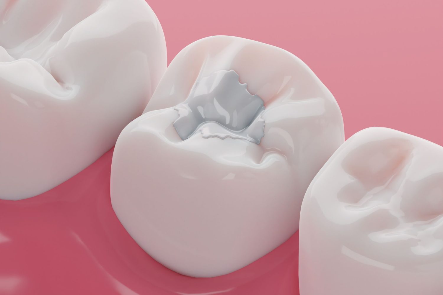 Odontopediatría en Chiclana de la Frontera, dentista para niños en Chiclana de la Frontera, odontología para niños en Chiclana, clínica dental para niños en Chiclana.