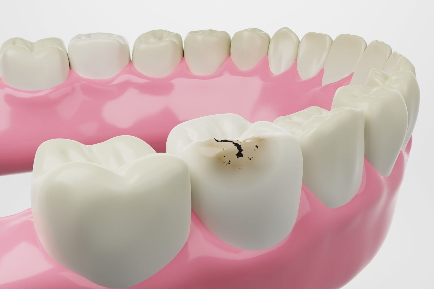 Odontopediatría en Chiclana de la Frontera, dentista para niños en Chiclana de la Frontera, odontología para niños en Chiclana, clínica dental para niños en Chiclana.